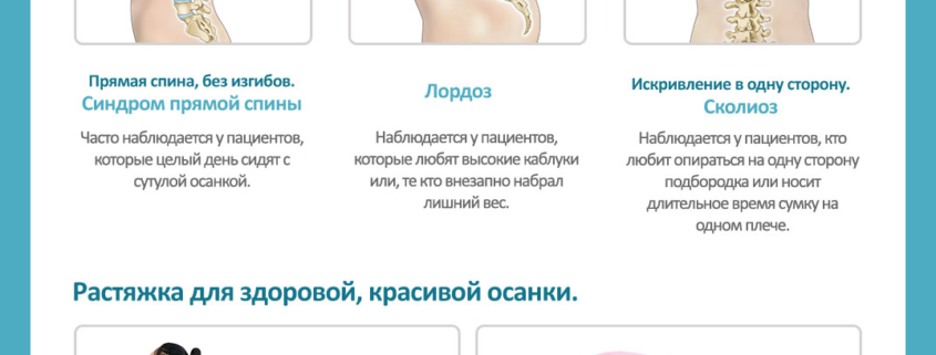 Оцените здоровье своего позвоночника по виду со спины! - Центр корейской медицины Часэн