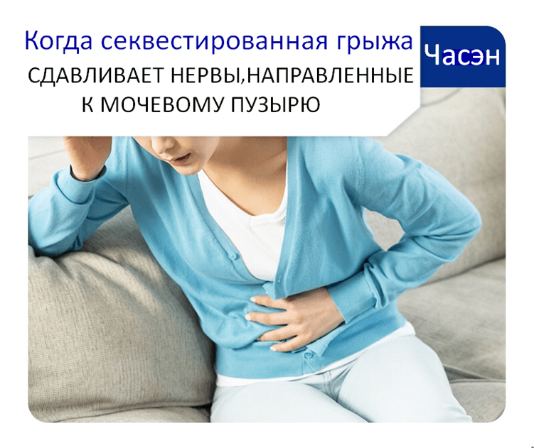 Нарушение мочеиспускания и проблемы дефекации