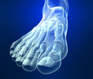 halluxvalgus