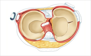 meniscus