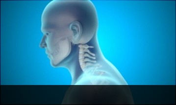 necksyndrome