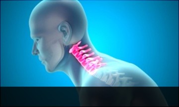 necksyndrome