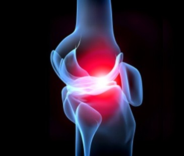 rheumatoid