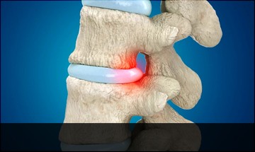 spine