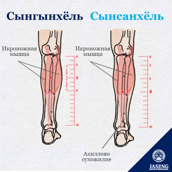 Если у вас онемение ног из-за диабета, помогут акупунктурные точки «сынгынхёль» и «сынсанхёль» Периферическая невропатия - одно из трех основных осложнений наряду с диабетической ретинопатией. Когда кровеносные сосуды повреждены, в связи с повышенным уровнем сахара в крови, в течение длительного времени, кровь и питательные вещества не поступают должным образом к периферическим кровеносным сосудам, что может вызвать онемение ног. В этом случае полезно проводить точечный массаж акупунктурных точек «сынгынхёль» и «сынсанхёль». Точка «сынгынхёль» расположена между латеральной и медиальной ветвями икроножной мышцы в верхней части задней стороны голени. А точка «сынсанхёль» находится ниже от точки «сынгынхёль», проще говоря, в месте углубления под сухожилием икроножной мышцы. Обе акупунктурные точки расположены в области мышц голени, которые помогают прокачивать вены, позволяя крови достигать периферических нервов. Стимуляция этих точек улучшает кровообращение и снимает онемение в ногах.