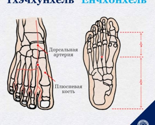 Люди с сахарный диабетом легко страдают хронической усталостью. Глюкоза, источник энергии нашего тела, постоянно выводится с мочой, поэтому легко теряются силы и появляется вялость. Кроме того, частое мочеиспускание затрудняет полноценный ночной сон и вызывает утомление. Когда увеличивается такая усталость, попробуйте точечный массаж точек «тхэчхунхёль» и «ёнчхонхёль». Точка «тхэчхунхёль» расположенна на верхней части стопы в вогнутой области между первым и вторым пальцами стопы. Точка «тхэчхунхёль» тесно связанна с печенью, а печень, в свою очередь, является одним из органов, отвечающих за усталость. Точечный массаж данной точки помогает не только восстановиться после лечения, а также избавиться от бессонницы, вызванной стрессом. Назнавание акупунктурной точки «ёнчхонхёль» содержит иероглиф, обозначающий «источник воды, пробивающийся наружу», поэтому данная точка является акупунктурной точкой, в которой возникает энергия и бодрость. Если стопу сомкнуть, точка «ёнчхонхёль» расположена на самой вогнутой части подошвы стопы. Точечный массаж этой точки эффективен для снятия усталости, психической и физической устойчивости и снятия стресса.
