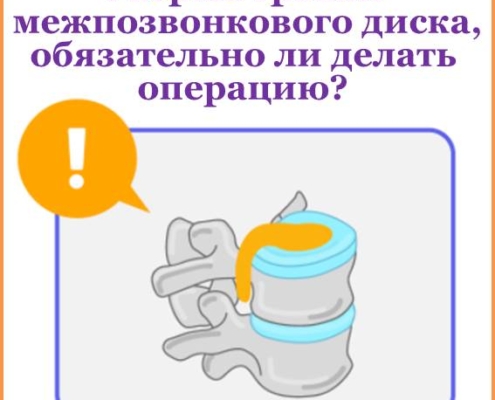 В нашу больницу обратился пациент со следующим вопросом: «У меня появились боли в спине и началось онемение в ногах, поэтому я пошел в больницу и прошел МРТ. Врач сказал, что мой диск разорвался и вытек и порекомендовал мне операцию. Но, вы знаете, у меня боль или онемение не настолько сильные, чтобы мешали мне в повседневной жизни... Скажите, операция – это единственный выход при разрыве грыжи межпозвонкового диска?»