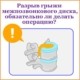 В нашу больницу обратился пациент со следующим вопросом: «У меня появились боли в спине и началось онемение в ногах, поэтому я пошел в больницу и прошел МРТ. Врач сказал, что мой диск разорвался и вытек и порекомендовал мне операцию. Но, вы знаете, у меня боль или онемение не настолько сильные, чтобы мешали мне в повседневной жизни... Скажите, операция – это единственный выход при разрыве грыжи межпозвонкового диска?»