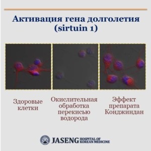 ** Сиртуин - наименование гена долголетия, связанного со старением и продолжительностью жизни, открытого профессором Массачусетского технологического института Леонардом Гаренти в 2000 году.